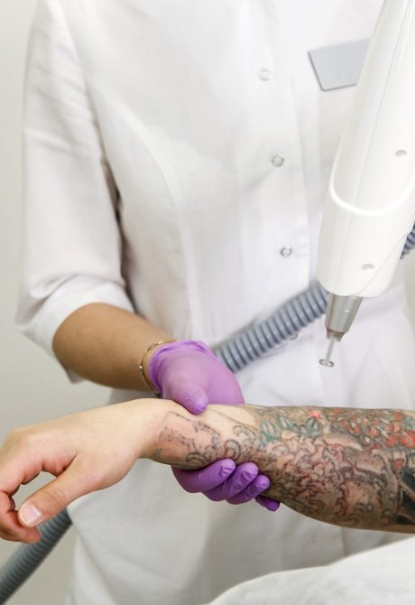 Cosmetologist with patient and professional tattoo removal laser from hand in salon